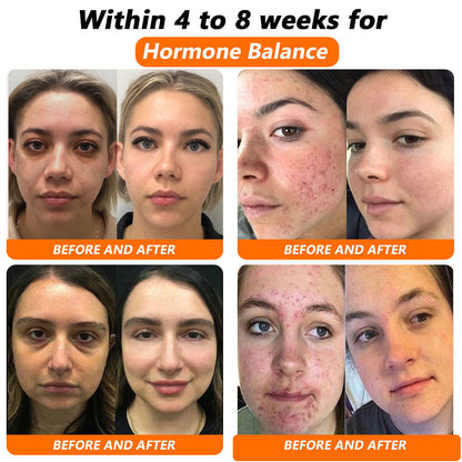 Bee Venom NMN Natural Repair Vaginal Capsules💗[Regulates hormone imbalance, obesity, acne, uterine fibroids and vaginal diseases]